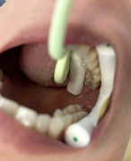Tandheelkundige kennis voor tandartsassistenten met maar liefst 40 open vragen! Test jou kennis!