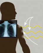 Radioprotectie Volledige samenvatting + notities - KdG MBRT