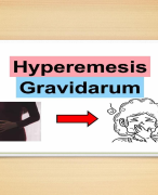 Hyperemesis gravidum causes, clinical factors, management 