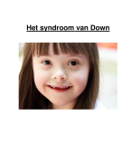 Het Syndroom van Down